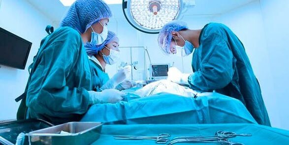 Operatsioon liikme suuruse suurendamiseks
